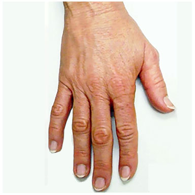 Ageing Hands