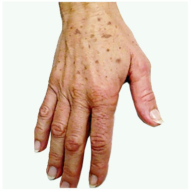 Ageing Hands