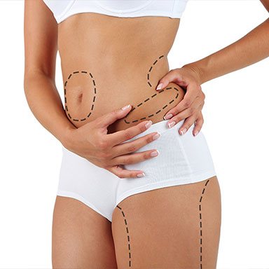 natural body sculpt - laser lipo
