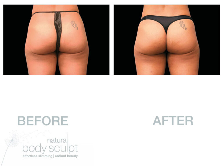 super-sculpt-1
